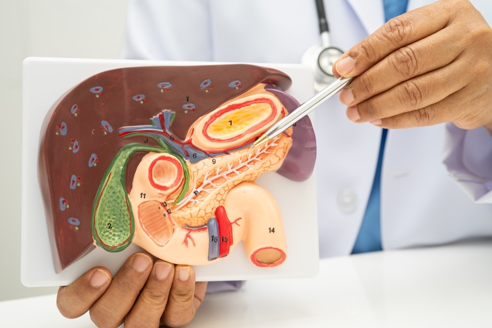 splenomegalia