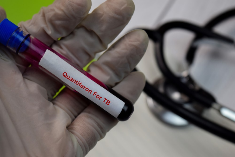quantiferon test