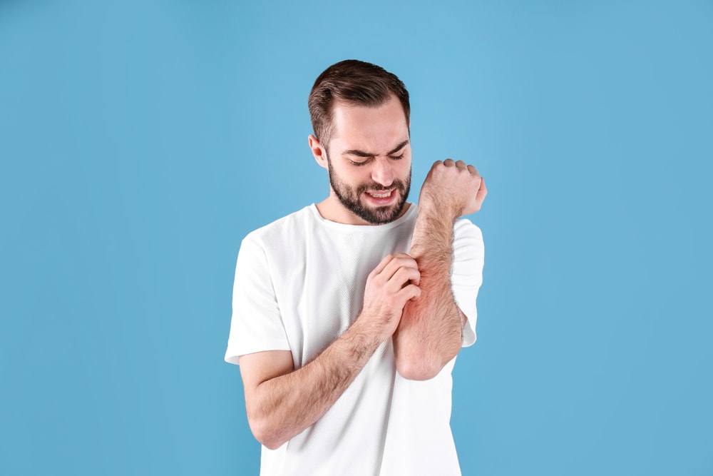 uomo si gratta delle punture di insetto