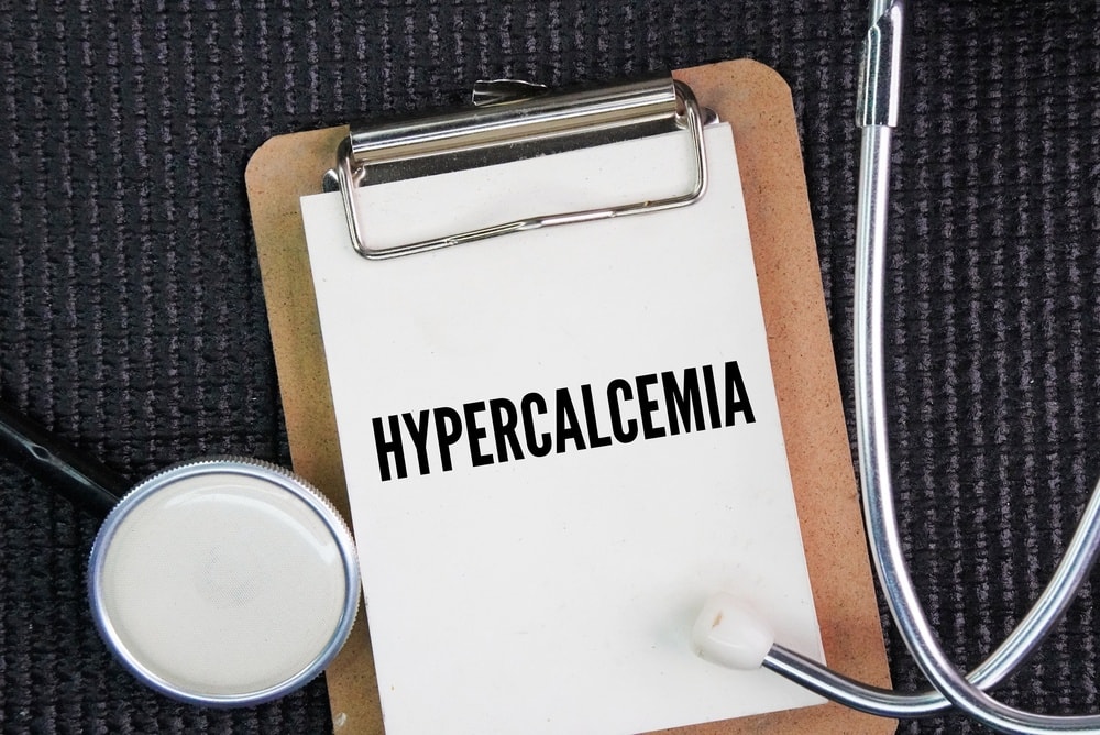 ipercalcemia