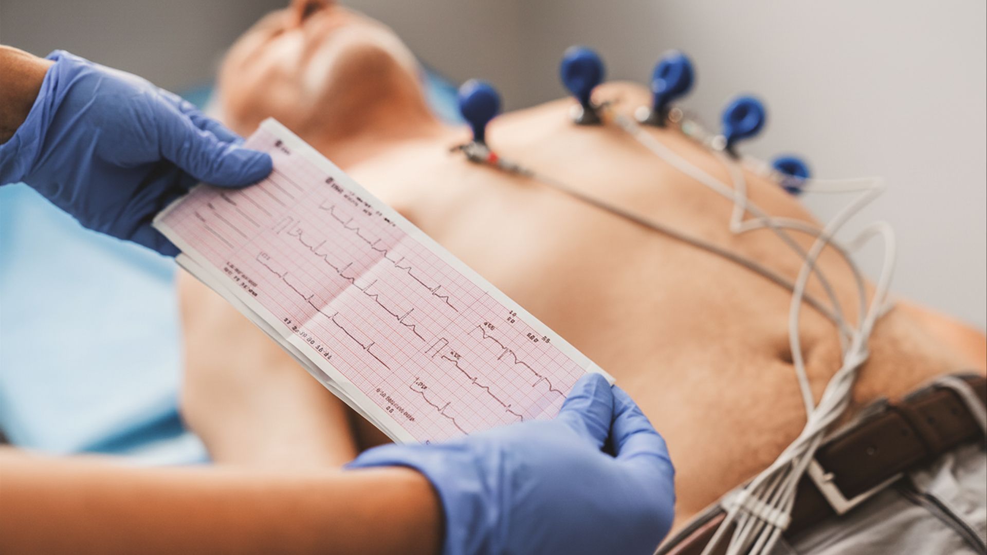 Elettrocardiogramma (ECG)